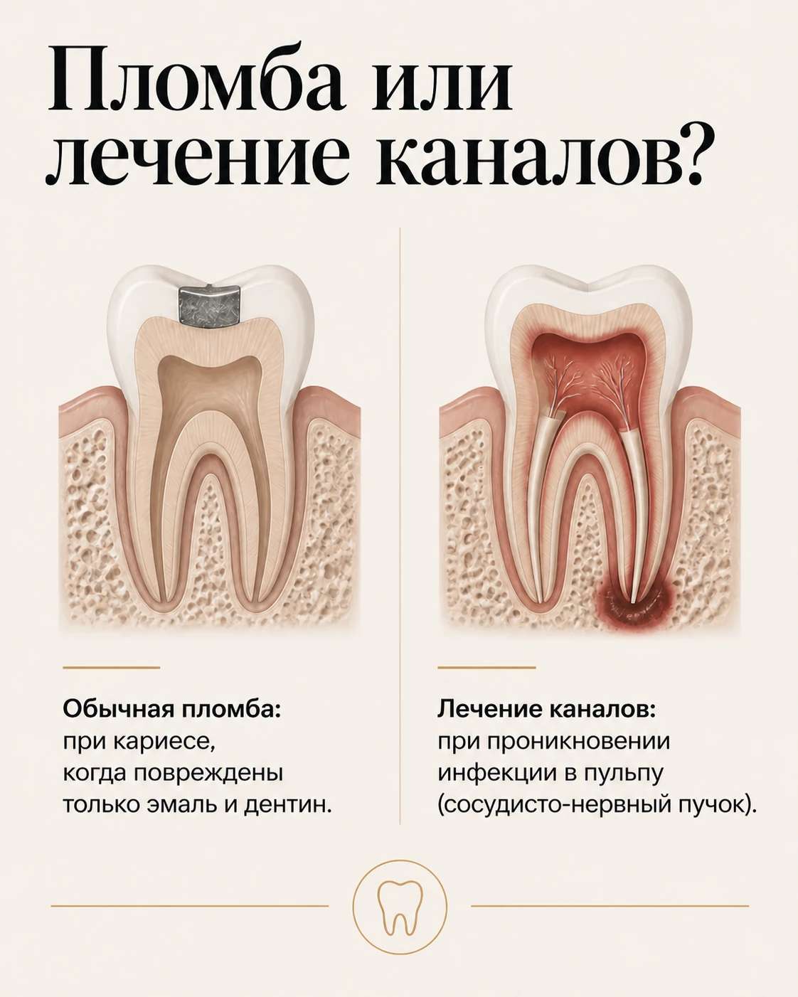 Слайд о случаях, когда может быть достаточно пломбы