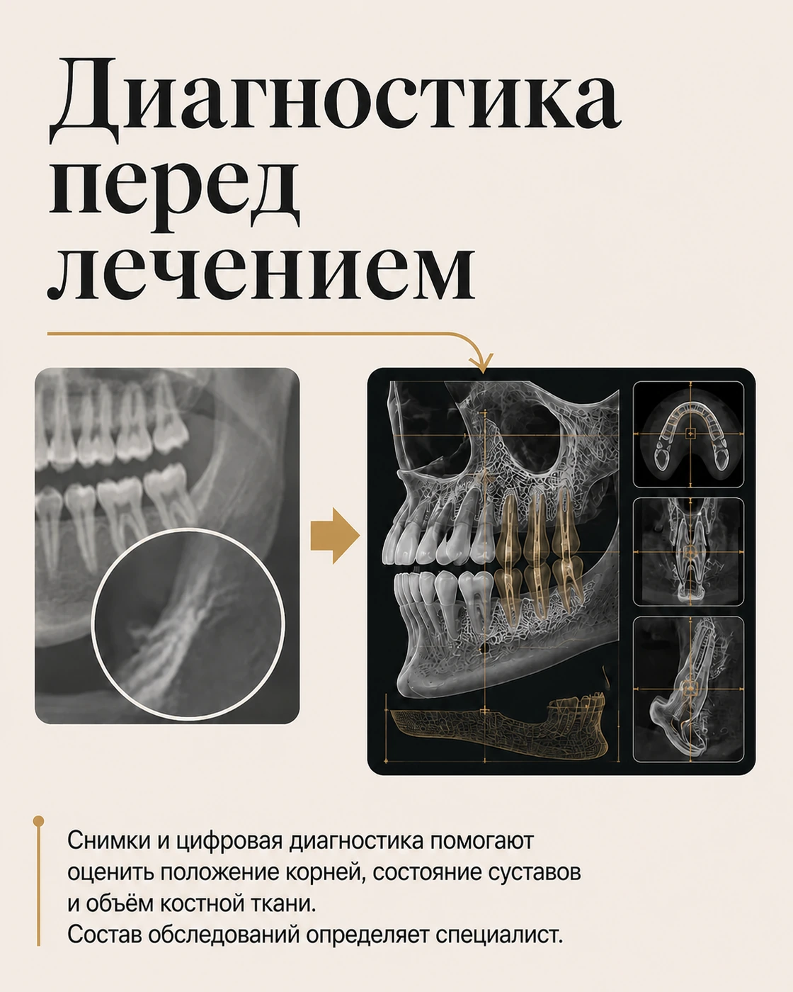 Слайд о диагностике перед лечением